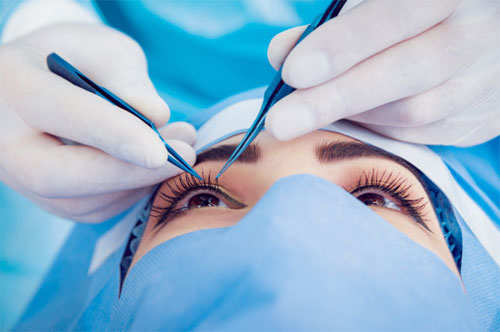 Chirurgie Ophtalmologique